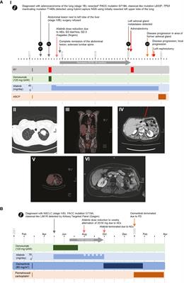 Activity of afatinib in patients with NSCLC harboring novel uncommon EGFR mutations with or without co-mutations: a case report